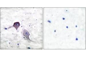 Immunohistochemistry analysis of paraffin-embedded human brain tissue, using Presenilin 1 Antibody. (Presenilin 1 antibody  (AA 1-50))