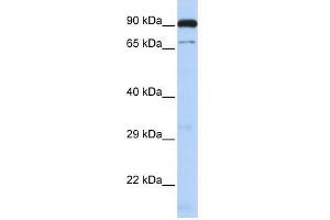 CTCFL antibody used at 1. (CTCFL antibody  (N-Term))