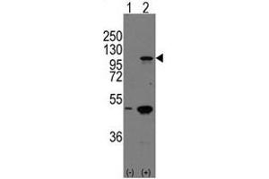 Image no. 2 for anti-P-Cadherin (CDH3) (C-Term) antibody (ABIN357039) (P-Cadherin antibody  (C-Term))