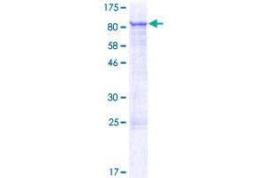 ZNF18 Protein (AA 1-549) (GST tag)