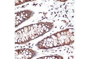 Immunohistochemistry of paraffin-embedded human colon using STK39 Rabbit mAb (ABIN1682890, ABIN3015922, ABIN3015923 and ABIN7101461) at dilution of 1:100 (40x lens). (STK39 antibody)