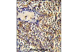 Formalin-fixed and paraffin-embedded human tonsil tissue reacted with CCL3 Antibody , which was peroxidase-conjugated to the secondary antibody, followed by DAB staining. (CCL3 antibody  (C-Term))