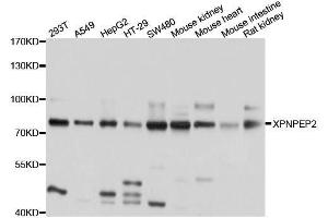 Western blot analysis of extracts of various cell lines, using XPNPEP2 antibody. (XPNPEP2 antibody  (AA 22-240))