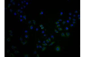Immunofluorescence staining of A549 cells with ABIN7139992 at 1:100, counter-stained with DAPI. (OR4C15 antibody  (AA 258-268))