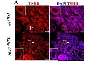 Immunofluorescence (Paraffin-embedded Sections) (IF (p)) image for anti-Thyroid Stimulating Hormone Receptor (TSHR) (AA 21-253) antibody (ABIN6149622)