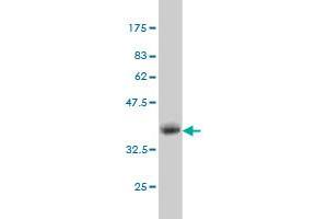 Western Blotting (WB) image for anti-dephospho-CoA Kinase Domain Containing (DCAKD) (AA 113-200) antibody (ABIN566399)