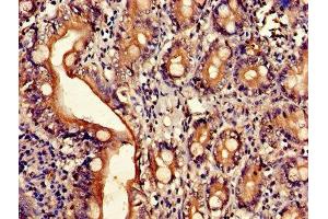 Immunohistochemistry of paraffin-embedded human small intestine tissue using ABIN7143509 at dilution of 1:100