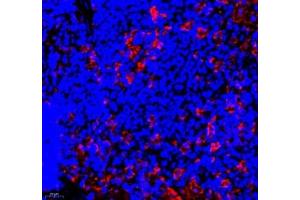 Immunofluorescence of paraffin embedded rat spleen using ANXA3 (ABIN7073065) at dilution of 1: 300 (400x lens) (Annexin A3 antibody)