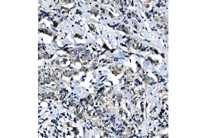 IHC analysis of EIF4A1 using anti-EIF4A1 antibody (ABIN7603143). (EIF4A1 antibody  (N-Term))