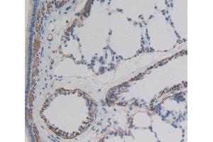 IHC-P analysis of lung tissue, with DAB staining. (ATG7 antibody  (AA 249-517))