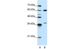 HNRPL antibody used at 0. (HNRNPL antibody  (N-Term))
