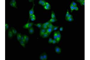 Immunofluorescence staining of HepG2 cells with ABIN7158788 at 1:100, counter-stained with DAPI. (LAPTM4A antibody  (AA 181-233))