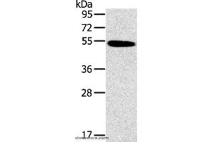 Western blot analysis of Human normal colon tissue, using HRH1 Polyclonal Antibody at dilution of 1:200 (HRH1 antibody)