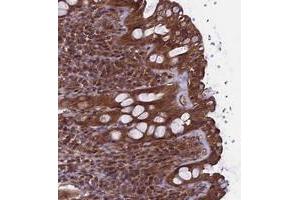 Immunohistochemical staining of human rectum with TTLL10 polyclonal antibody  shows moderate cytoplasmic positivity in glandular cells at 1:50-1:200 dilution.