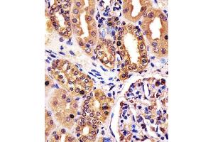 (ABIN6242612 and ABIN6578254) staining RNF7 in human kidney tissue sections by Immunohistochemistry (IHC-P - paraformaldehyde-fixed, paraffin-embedded sections). (RNF7 antibody  (N-Term))