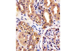 (ABIN6242612 and ABIN6578254) staining RNF7 in human kidney tissue sections by Immunohistochemistry (IHC-P - paraformaldehyde-fixed, paraffin-embedded sections).