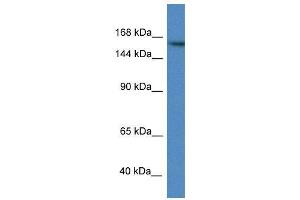 WB Suggested Anti-ZBTB40 AntibodyTitration: 1. (ZBTB40 antibody  (N-Term))