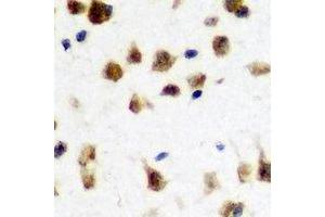 Immunohistochemical analysis of FMR1 staining in rat brain formalin fixed paraffin embedded tissue section. (FMR1 antibody)