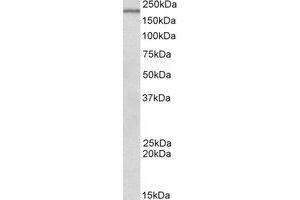 Western Blotting (WB) image for anti-DENN/MADD Domain Containing 4C (DENND4C) (AA 31-45) antibody (ABIN793263) (DENND4C antibody  (AA 31-45))