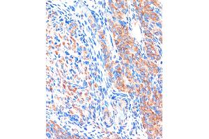 Immunohistochemistry of paraffin-embedded Rat ovary using ME3 Rabbit pAb (ABIN7268384) at dilution of 1:100 (40x lens). (ME3 antibody  (AA 505-604))
