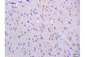 Formalin-fixed and paraffin embedded rat brain labeled with Anti-CCDC11 Polyclonal Antibody, Unconjugated  at 1:200 followed by conjugation to the secondary antibody and DAB staining. (CCDC11 antibody  (AA 330-380))