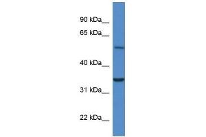 Western Blot showing Cyb5r4 antibody used at a concentration of 1. (CYB5R4 antibody  (N-Term))