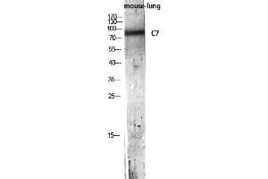 Western Blot (WB) analysis of Mouse Lung lysis using C7 antibody.