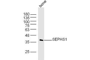 Mouse bone lysates probed with SEPHS1 Polyclonal Antibody, Unconjugated  at 1:300 dilution and 4˚C overnight incubation. (SEPHS1 antibody  (AA 2-100))