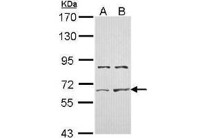 WB Image Sample (30 ug of whole cell lysate) A: Hela B: Hep G2 , 7. (ACVR2A antibody)