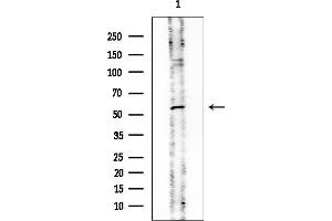 Western blot analysis of lysates from EC304 cells, using PPP3CB Mouse Monoclonal Antibody at 1/1000 dilution.