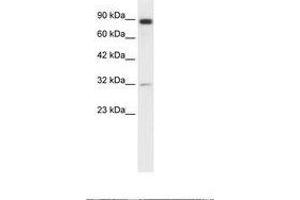 Image no. 1 for anti-Matrix Metallopeptidase 9 (Gelatinase B, 92kDa Gelatinase, 92kDa Type IV Collagenase) (MMP9) (AA 172-221) antibody (ABIN203273) (MMP 9 antibody  (AA 172-221))