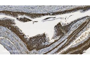 IHC analysis of U2AF65/U2AF2 using anti U2AF65/U2AF2 antibody (ABIN7600794). (U2AF2 antibody  (AA 238-470))