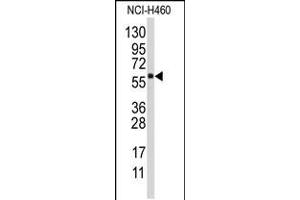 Western blot analysis of anti-CYP4F12 Antibody in NCI-H460 cell line lysates (35ug/lane). (CYP4F12 antibody  (C-Term))