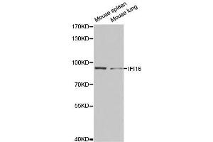 Western blot analysis of extracts of various cell lines, using IFI16 antibody. (IFI16 antibody  (AA 1-300))