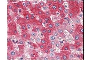 Immunohistochemical analysis of paraffin-embedded human liver tissues using FGFR4 antibody. (FGFR4 antibody)