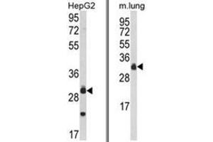 (LEFT) Western blot analysis of MyD88 Antibody (Center) in HepG2 cell line lysates (35ug/lane). (MYD88 antibody  (Middle Region))