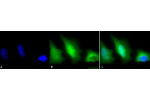 Immunocytochemistry/Immunofluorescence analysis using Rabbit Anti-SOD (Cu/Zn) Polyclonal Antibody (ABIN361651 and ABIN361652).