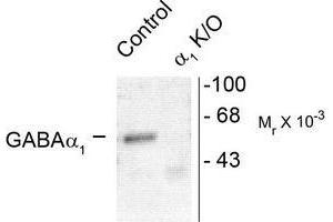 Image no. 1 for anti-gamma-aminobutyric Acid (GABA) A Receptor, alpha 1 (GABRA1) (Cytoplasmic Loop) antibody (ABIN372626)