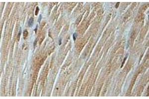 Immunohistochemical staining of formalin-fixed paraffin-embedded human fetal skeletal muscle showing staining with AP3D1 polyclonal antibody  at 1:100 dilution.