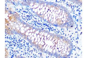 Immunohistochemistry of paraffin-embedded human appendix using V Rabbit mAb (ABIN7271317) at dilution of 1:100 (40x lens). (VAMP8 antibody)