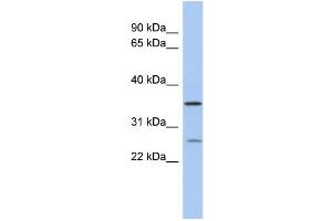 WB Suggested Anti-SDR-O Antibody Titration: 0. (SDR9C7 antibody  (Middle Region))