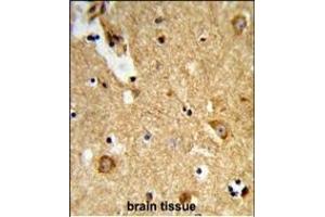 Immunohistochemistry (Paraffin-embedded Sections) (IHC (p)) image for anti-Ectonucleoside Triphosphate diphosphohydrolase 2 (ENTPD2) (AA 86-113), (N-Term) antibody (ABIN653273)