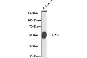 Western blot analysis of extracts of Rat brain using EIF2S3 Polyclonal Antibody at dilution of 1:1000. (EIF2S3 antibody)