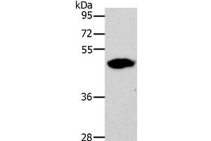 Western Blot analysis of 293T cell using LOX Polyclonal Antibody at dilution of 1:500 (LOX antibody)