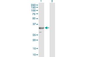 Western Blot analysis of TRADD expression in transfected 293T cell line by TRADD MaxPab polyclonal antibody. (TRADD antibody  (AA 1-312))