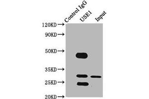 Immunoprecipitating USE1 in PC-3 whole cell lysate Lane 1: Rabbit control IgG (1 μg) instead of ABIN7175459 in PC-3 whole cell lysate. (UBE2Z antibody  (AA 1-146))