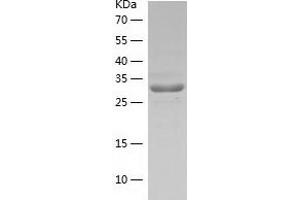 Western Blotting (WB) image for Calcium Binding Protein 39 (CAB39) (AA 1-341) protein (His tag) (ABIN7289497) (CAB39 Protein (AA 1-341) (His tag))