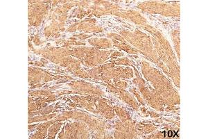 Immunohistochemistry (IHC) image for anti-Actin, alpha 1, Skeletal Muscle (ACTA1) antibody (ABIN3026689)