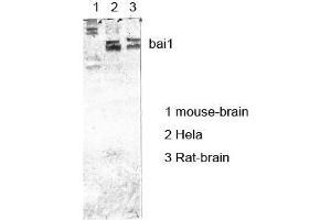 Western Blot (WB) analysis of specific cells using antibody diluted at 1:1000. (BAI1 antibody)