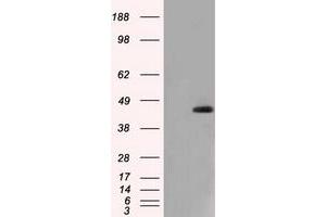 HEK293T cells were transfected with the pCMV6-ENTRY control (Left lane) or pCMV6-ENTRY NXNL2 (Right lane) cDNA for 48 hrs and lysed. (NXNL2 antibody)